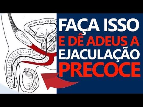 Guia prático de exercícios para acabar com a ejaculação precoce